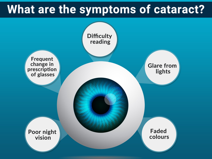 Symptoms Of Cataract Infographic Jaheed Khan 