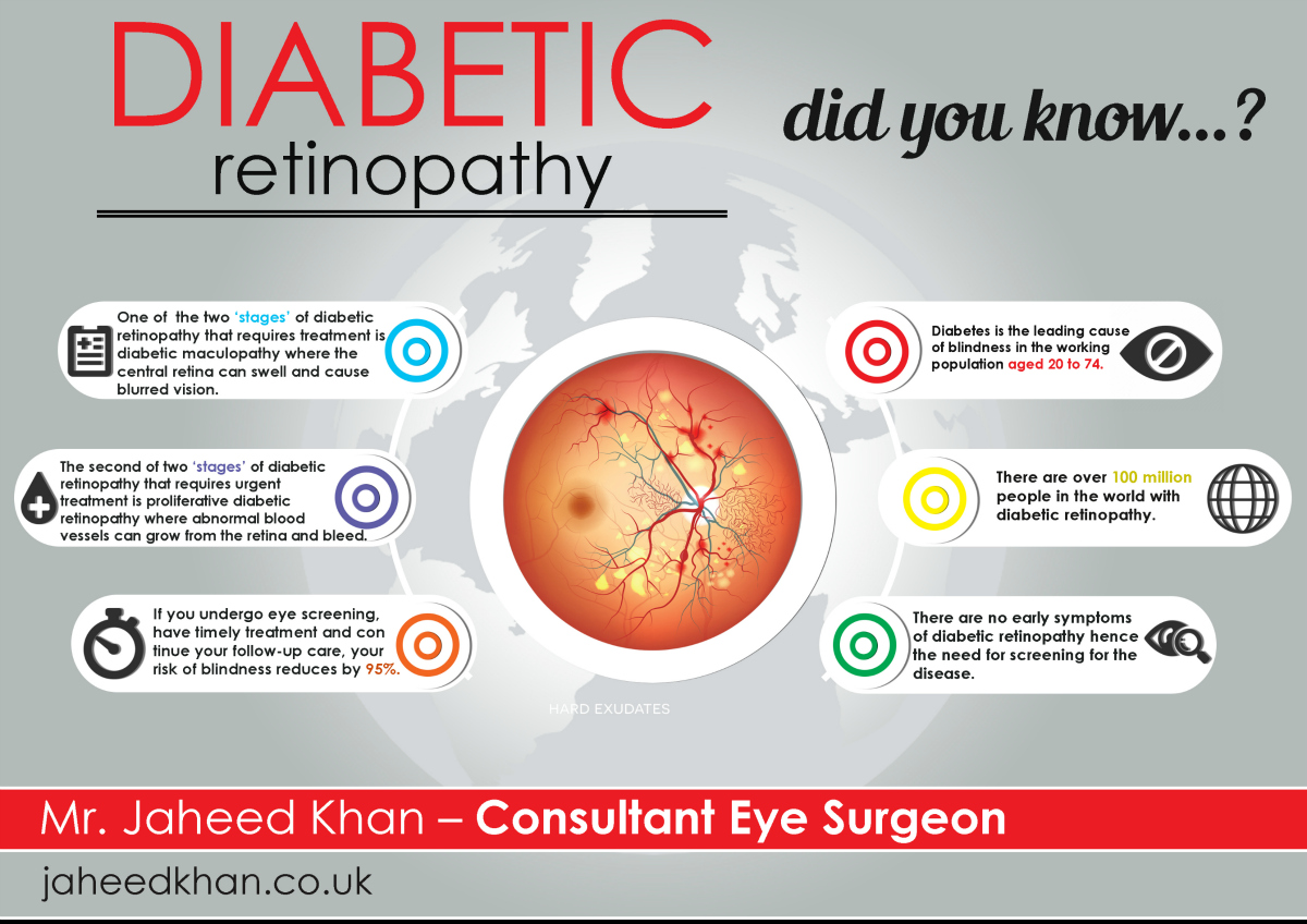 diabetic-maculopathy